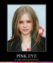 celebrity-pictures-avril-lavigne-pink-eye.jpg